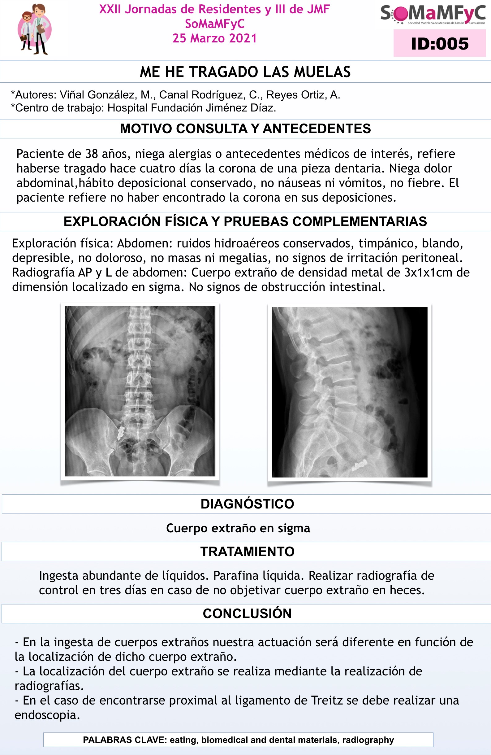 005_Me_he_tragado_las_muelas_2021.001__002_