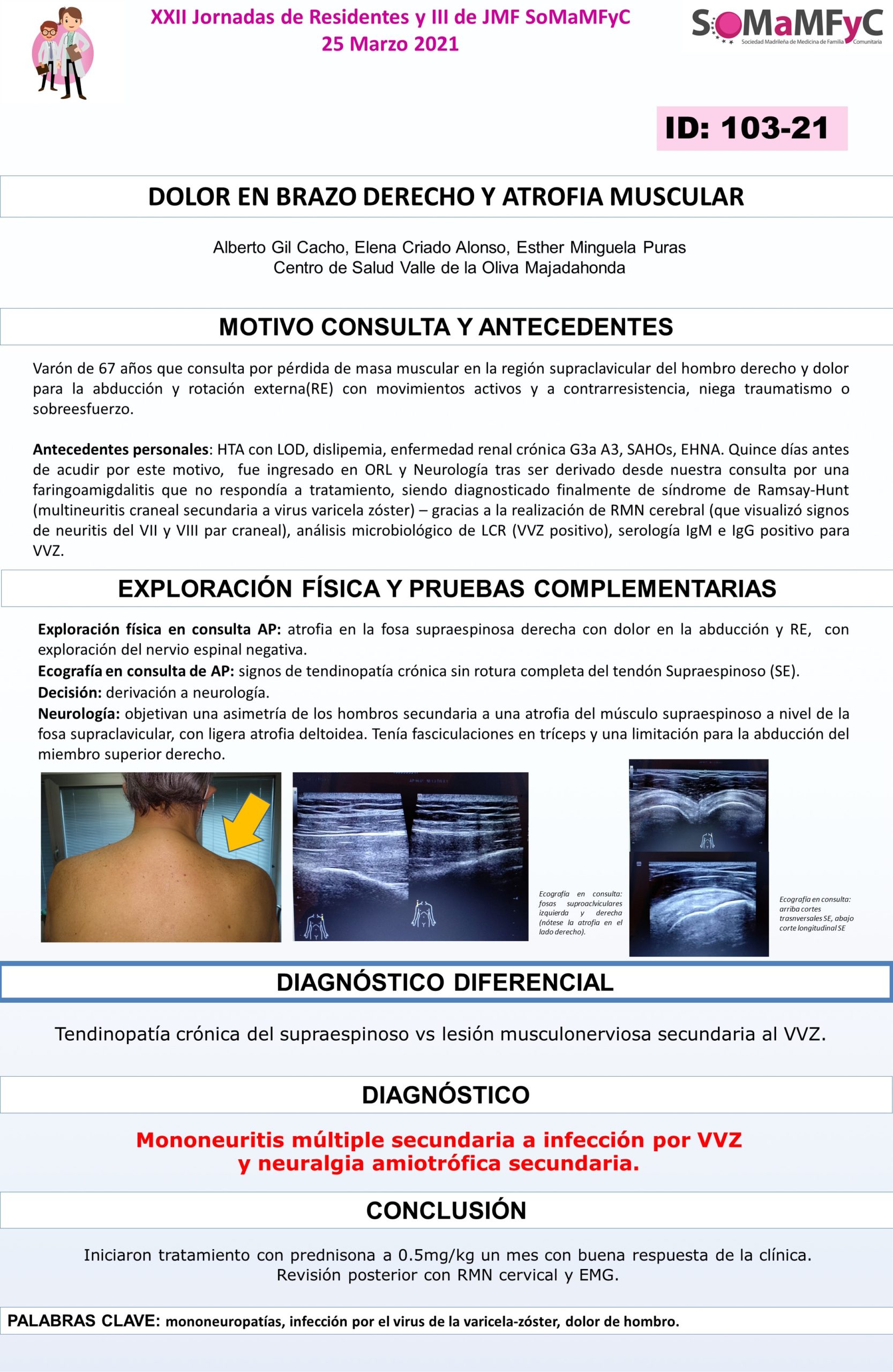 103-21-_DOLOR_DE_BRAZO_Y_ATROFIA_MUSCULAR