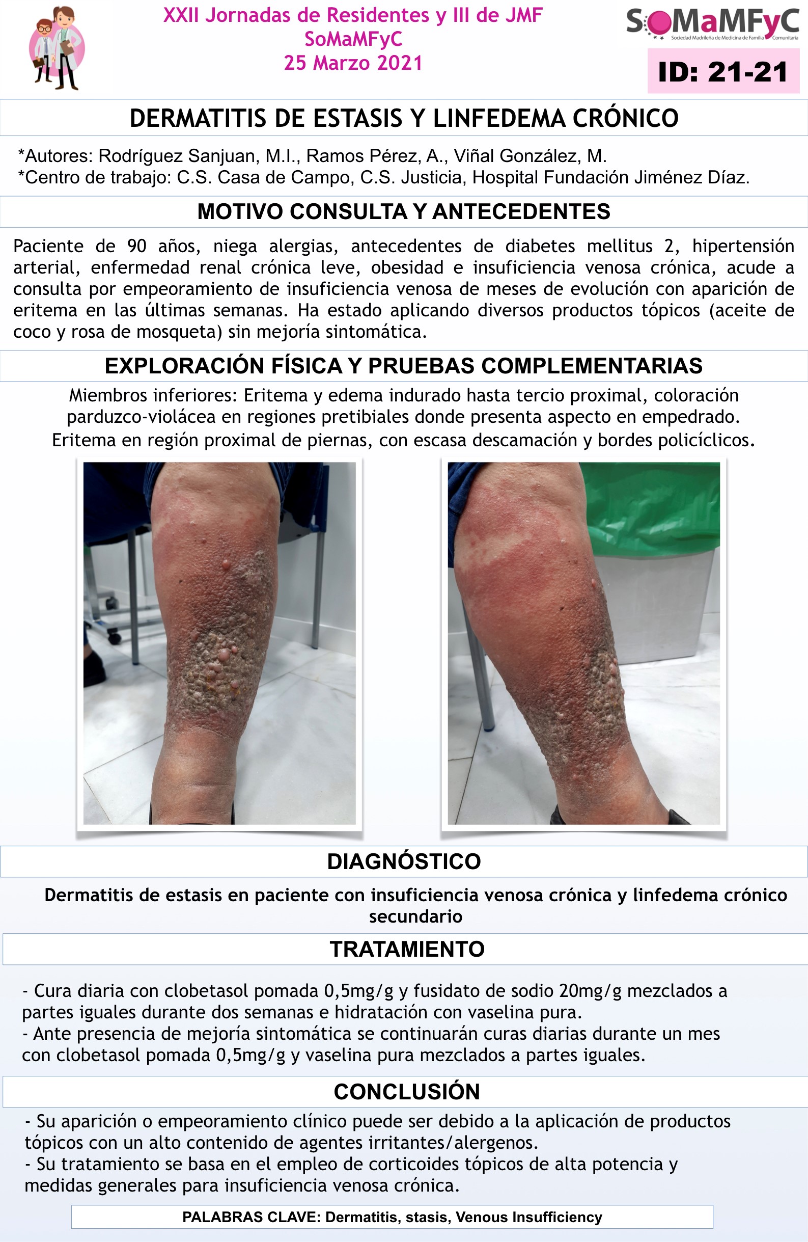 21-21_Dermatitis_de_estasis_y_linfedema_cronico_2021.001__002_.jpg