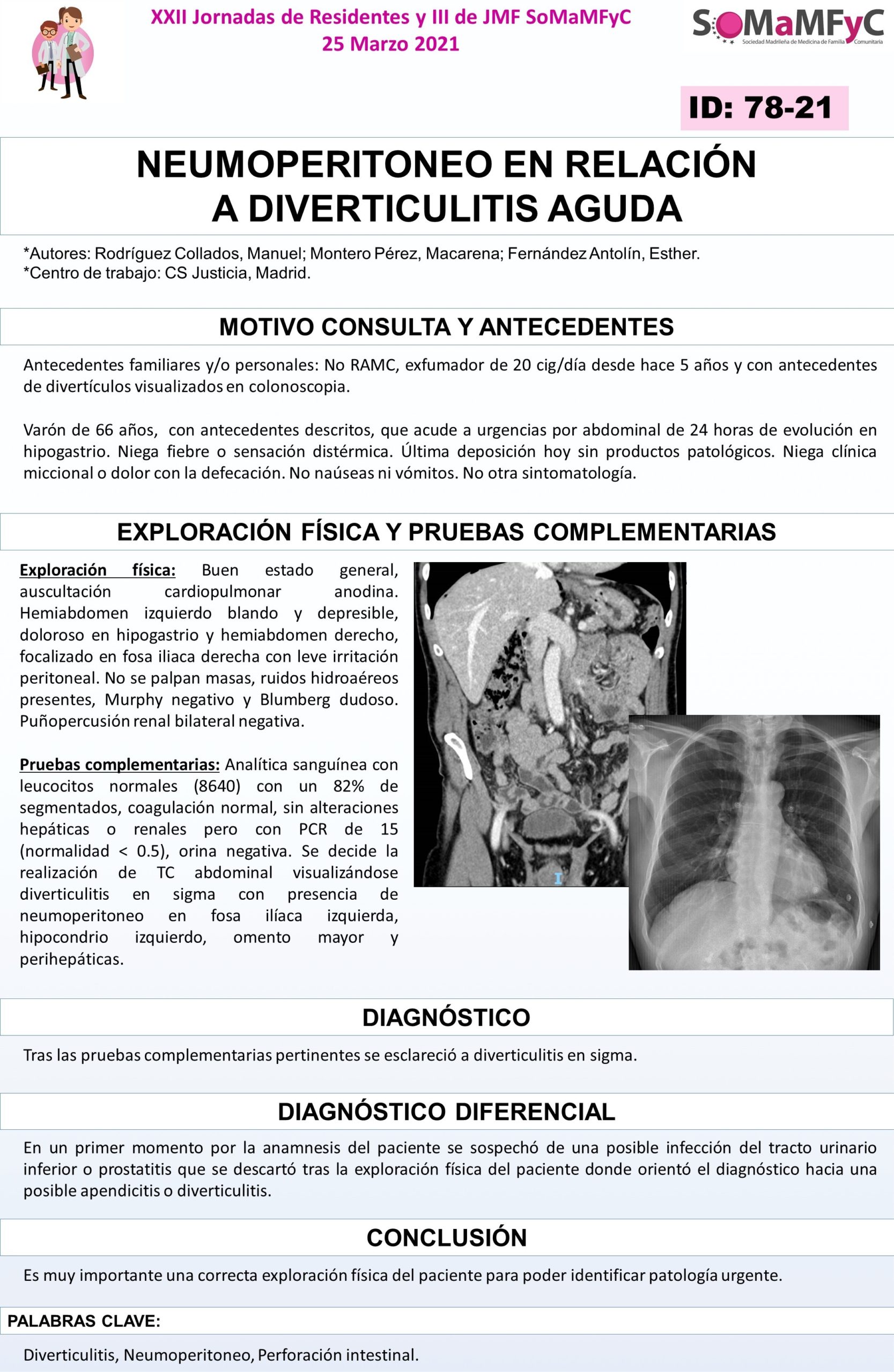 78-21_NEUMOPERITONEO_EN_RELACION_A_DIVERTICULITIS_AGUDA__002_